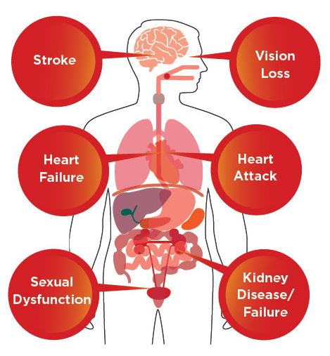 Outline of human body with the types of conditions high blood pressure can cause